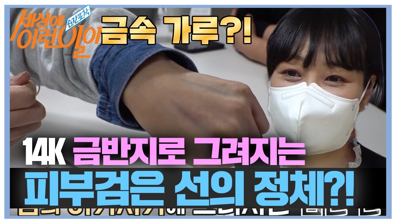 ‘흑색피부그림증’ 14K 반지에 반응하는 피부 #순간포착세상에이런일이 #WhatonEarth #SBSstory - YouTube