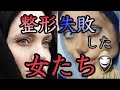 本当に怖い！整形失敗してとんでもない顔になった女性たち！