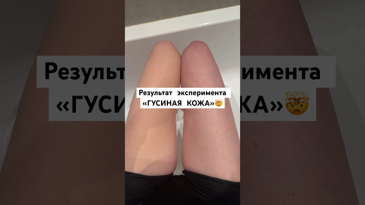 РЕЗУЛЬТАТ🤯 Энзимная пудра 142044104 и Крем с мочевиной 124736678 (wb) #гусинаякожа #кератоз