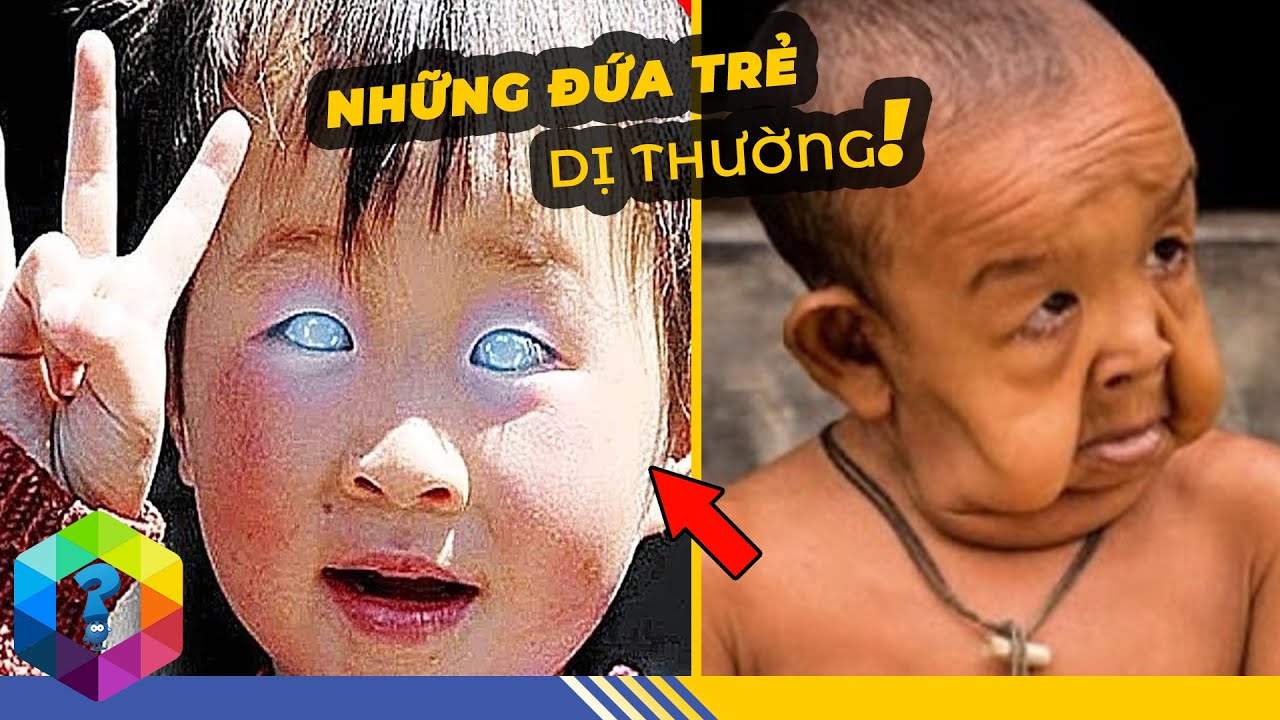 Những Đứa Trẻ Đặc Biệt Đến "Dị Thường" Nổi Tiếng Trên Thế Giới - Không Tin Là Đang Tồn Tại