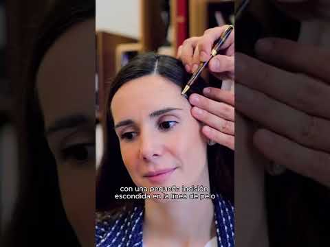 Elevación de cejas | Técnica Gliding Brow Lift