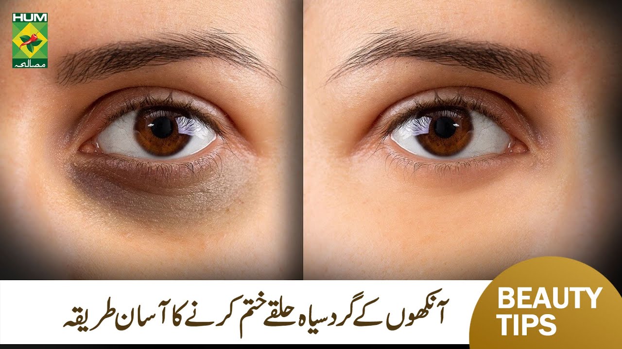 ankhon-ke-halke-khatam-karne-ka-tarika-remedy-for-removing-dark