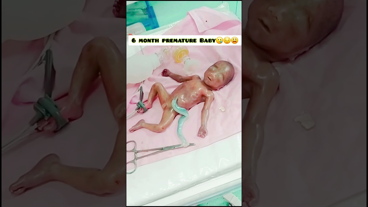 Premature Baby😌#prematurebaby#babyboy #nicubaby#hospital#hospitality hospi