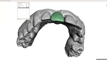 MeshMixer - Single Tooth Waxup - 2 Techniques