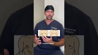 Lets Talk Gynecomastia Surgery