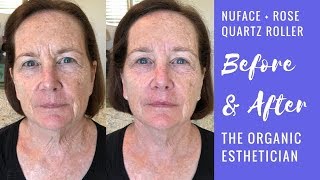 Anti-Aging NuFace Microcurrent  + Rose Quartz Roller Before & After on My Mom