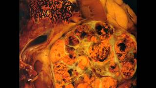 Blasted Pancreas - Hemangiosarcoma