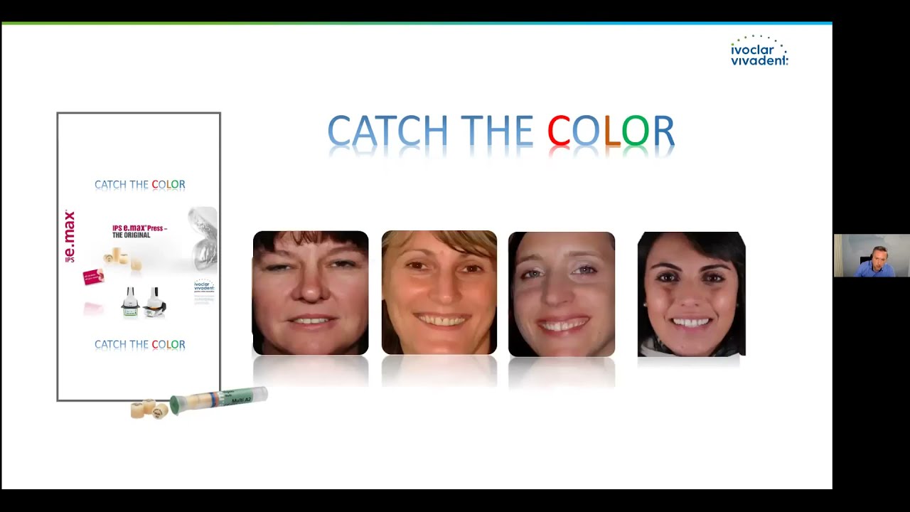 Dental Technicians - Dieter Grübel Live on "The true Multi-Talent - IPS e.max Press Multi"