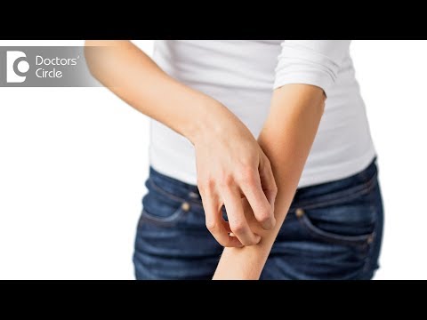 Is Itchy Skin sign of Diabetes? - Dr. Swetha Sunny Paul