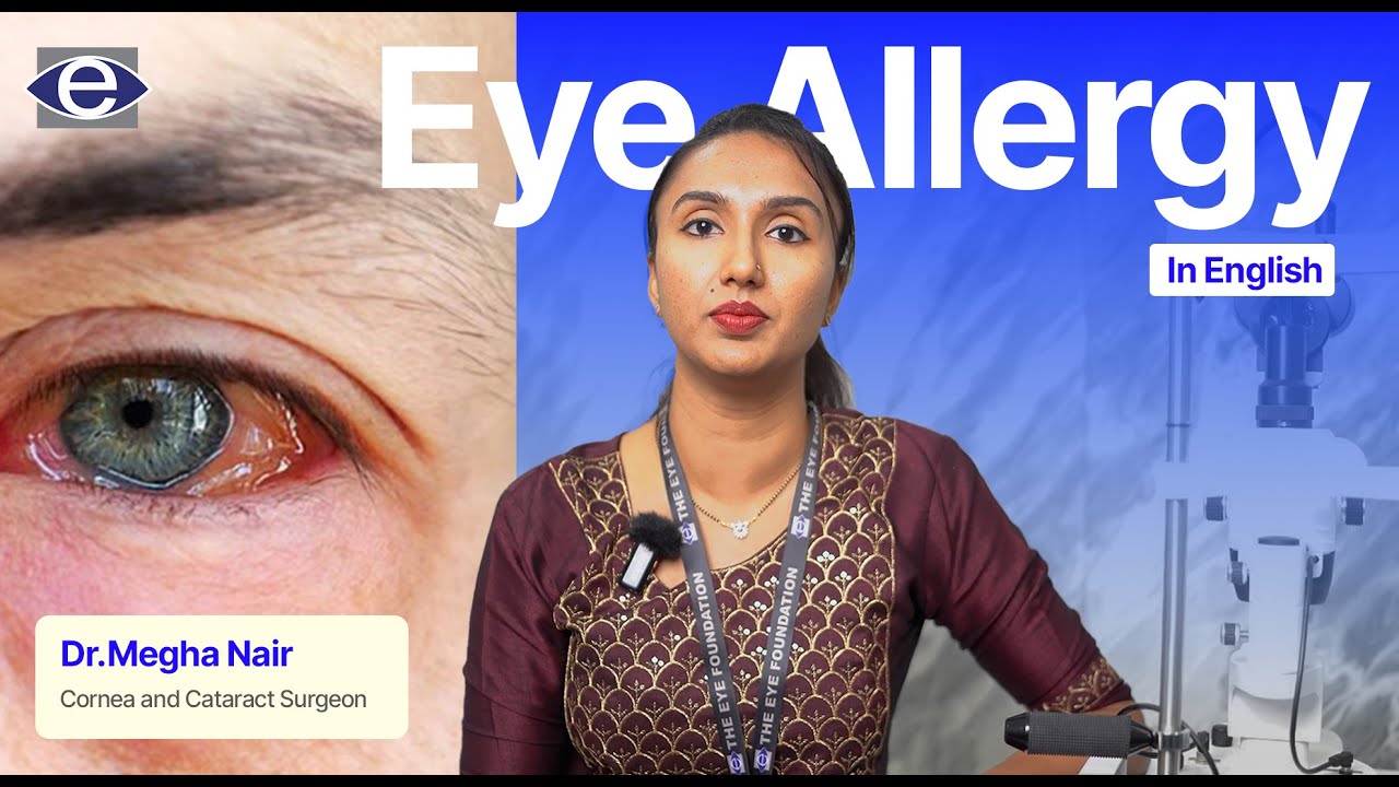 Eye Allergies | Common Eye Conditions | The Eye Foundation 