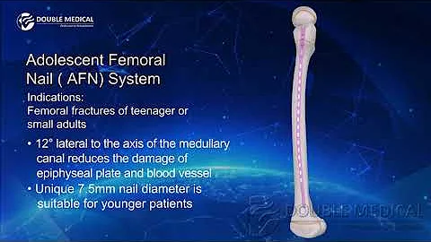 Double Medical Adolescent Femoral Nail  (AFN) System
