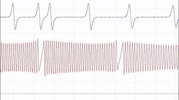 PicoScope Diagnostics: Toyota Hilux noise & sporadic injector operation