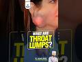 Throat Lumps Explained by ENT Specialist Dr. Lovekesh Mittal | Healing Hospital Chandigarh