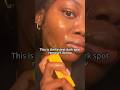 I have tried everything and nothing works like this bar👏 #skincare #turmericsoap #darkspots