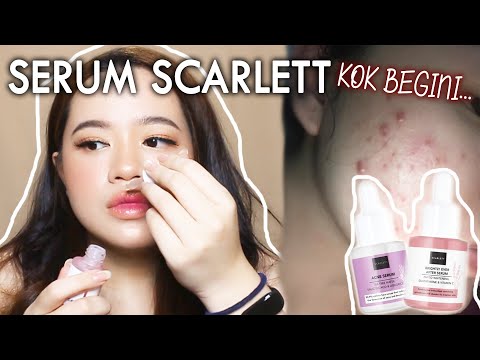 REVIEW JUJUR : Serum Scarlett (PAKAI 3 MINGGU)