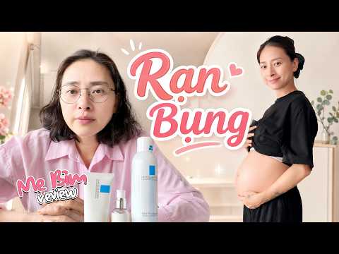 How to Prevent STRETCH MARKS During Pregnancy // Mommy Review Series
