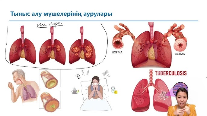 Жалаңаш жұлдыздар глюкоза