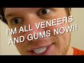 When your bro gets veneers