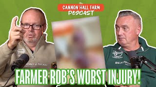 Farmer Rob's Worst Farming Injury! 🤕