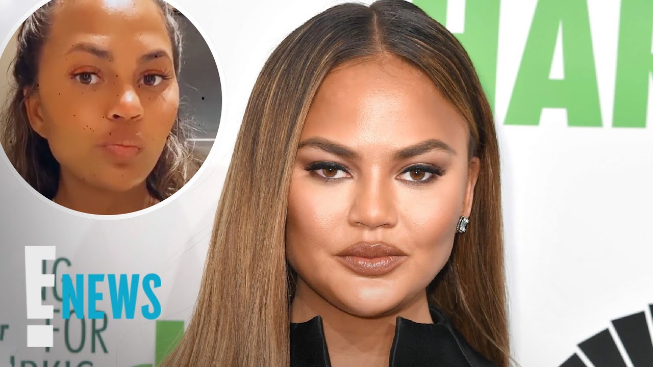 Chrissy Teigen Claps Back at Accusatory Weight Loss Claim News