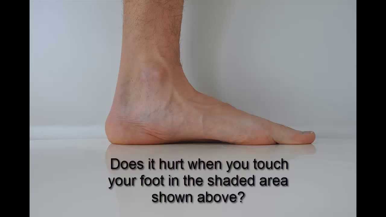 Navicular Palpation - YouTube