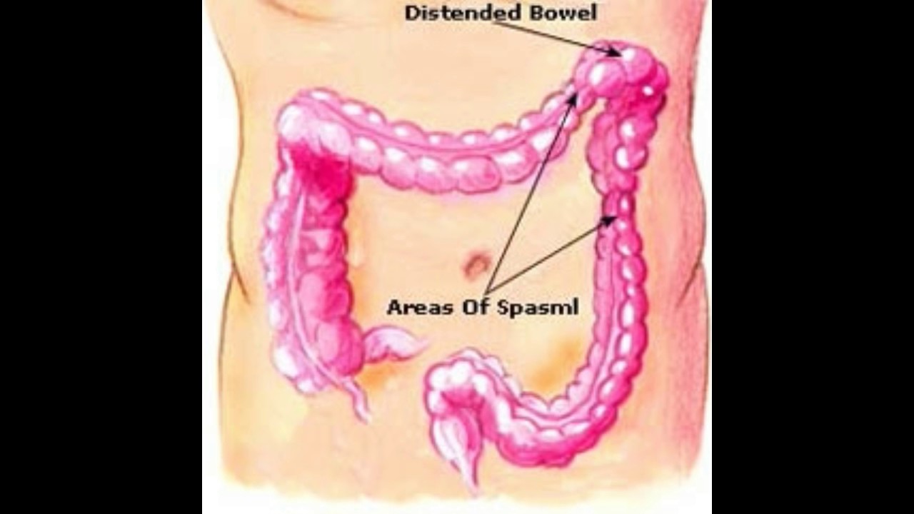 What Is The Splenic Flexure