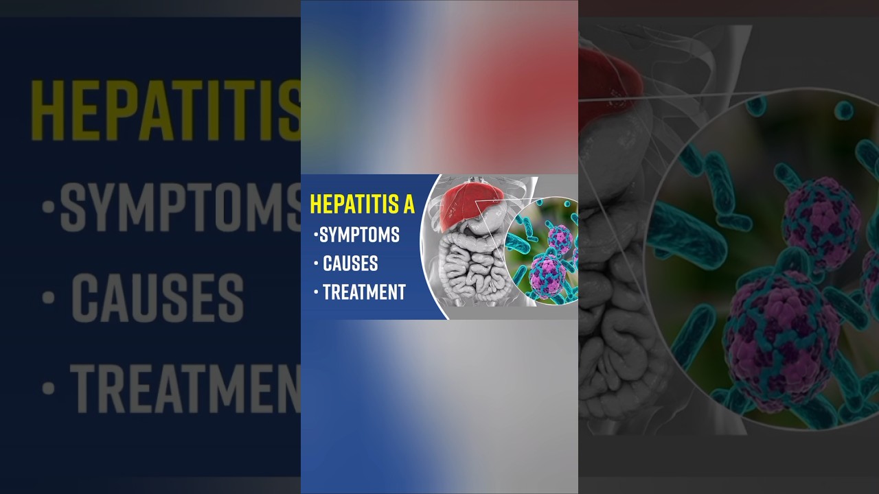 HEPATITIS A : Symptoms Causes Treatment Prevention 
