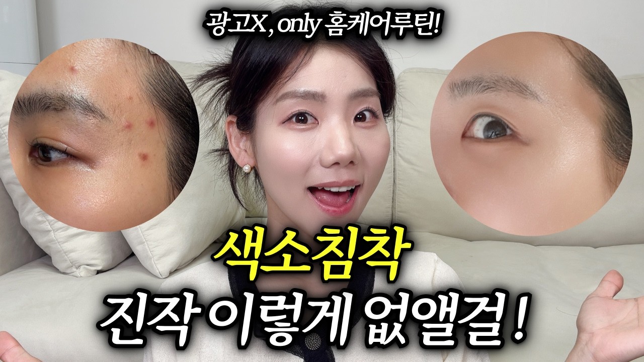 광고❌ 색소침착 이렇게 관리 했더니 싹 없어졌어요!! 따라하면 무조건 피부 좋아지는 스킨케어루틴 공개!