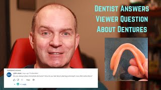 Do I always make an immediate denture ? by Very Nice Smile Dental 748 views 2 months ago 11 minutes, 29 seconds