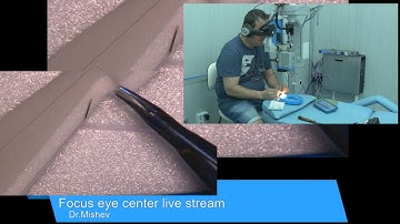 Virtual retinal projection 3D Avegant glyph, first surgical experience Lukan Mishev Live Stream