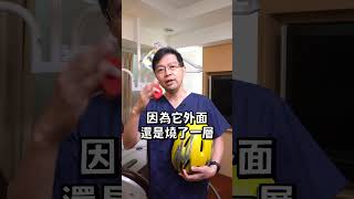 #shorts 根管治療後假牙牙套怎麼挑? #shorts 根管治療後假牙牙套怎麼挑?