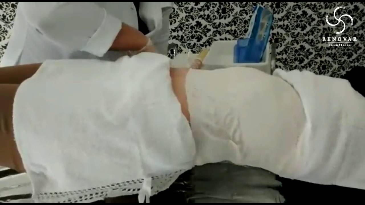Aplicação de Gesso Redutor Abdominal