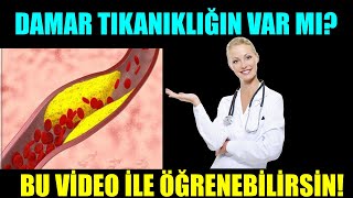 Damar Tikanikliğin Olup Olmadiğini Anlamak İsti̇yorsan Bu Vi̇deoyu İzle