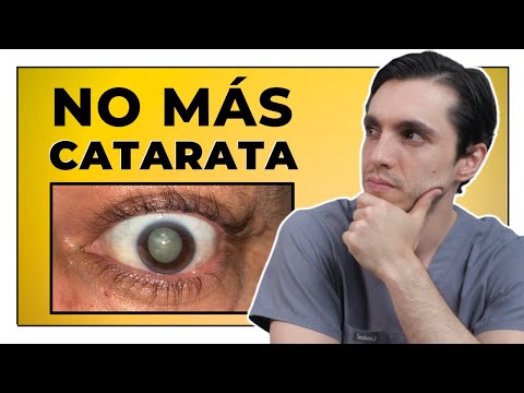 Catarata:  Tratamiento REAL que funciona 💡 ¿Cómo eliminarla para siempre? 💡