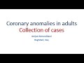 Coronary anomalies in adults