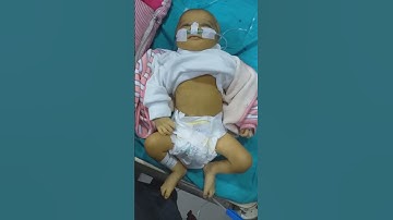 JAUNDICE NEONATORUM: CANDIDATE OF EXCHANGE TRANSFUSION