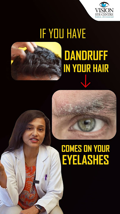 5 Causes Stye on Your Eyelid ? | How To Get Rid Of Stye From Eye | Vision Eye Centre