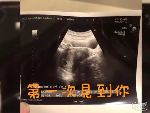 喜寶妹の出生紀錄