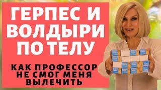 Герпес по Телу и Волдыри. Ужасы После Ночи Герпес по Телу и Волдыри. Ужасы После Ночи