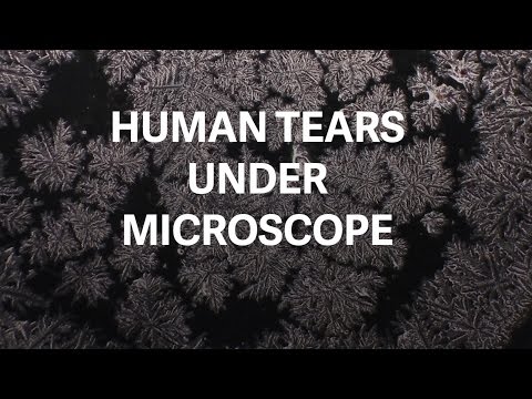 Micrograph photos reveal the unique beauty of tears