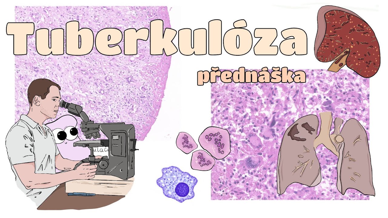 Patologie - Tuberkulóza (CZ)
