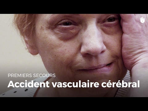 Vidéo: Les Premiers Symptômes D'un Accident Vasculaire Cérébral Et 7 Mesures De Premiers Soins D'urgence