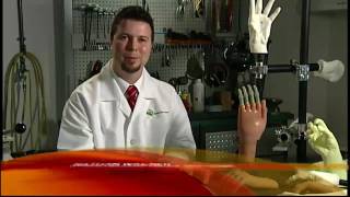 World s First Bionic Fingers