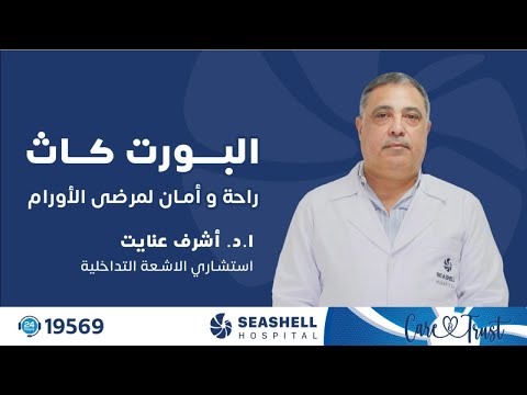 البورت كاث لمرضى الأورام وسيلة أمان في رحلة العلاج الكيماوي