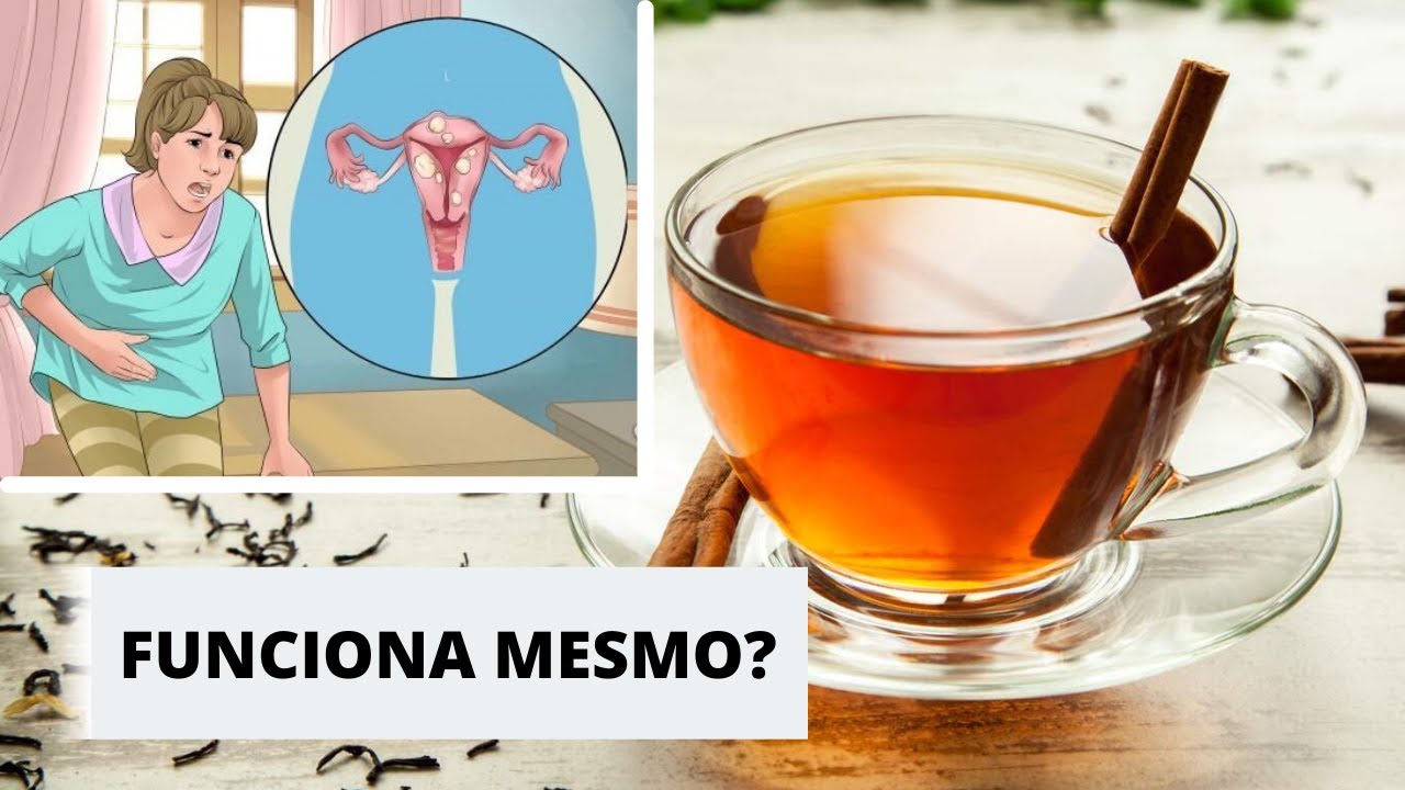 Chá De Canela Menstruação - NAZAEDU