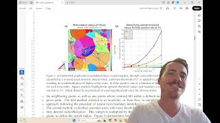 Your EBSD Map Is Hiding a 45-Grain Twin Network