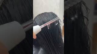 Anti hair fall control treatment with ozone therapy treatment full process video transformation