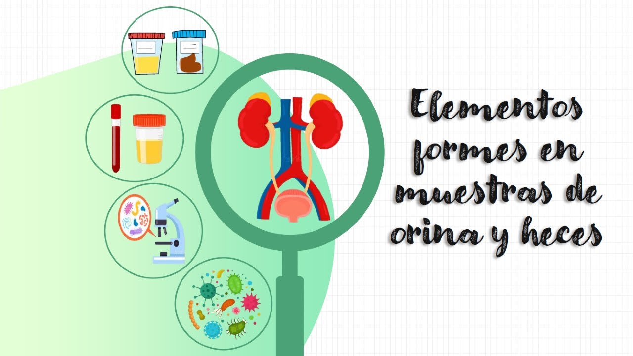 an-lisis-breve-de-elementos-formes-en-orina-y-heces-youtube