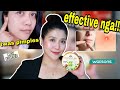 SOLUSYON SA PIMPLES | LUXE ORGANIX ALOE VERA AND SNAIL REVIEW AND TIPS | May Santos