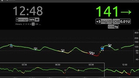 How to setup and install Nightscout with heroku, Github and MongoDB